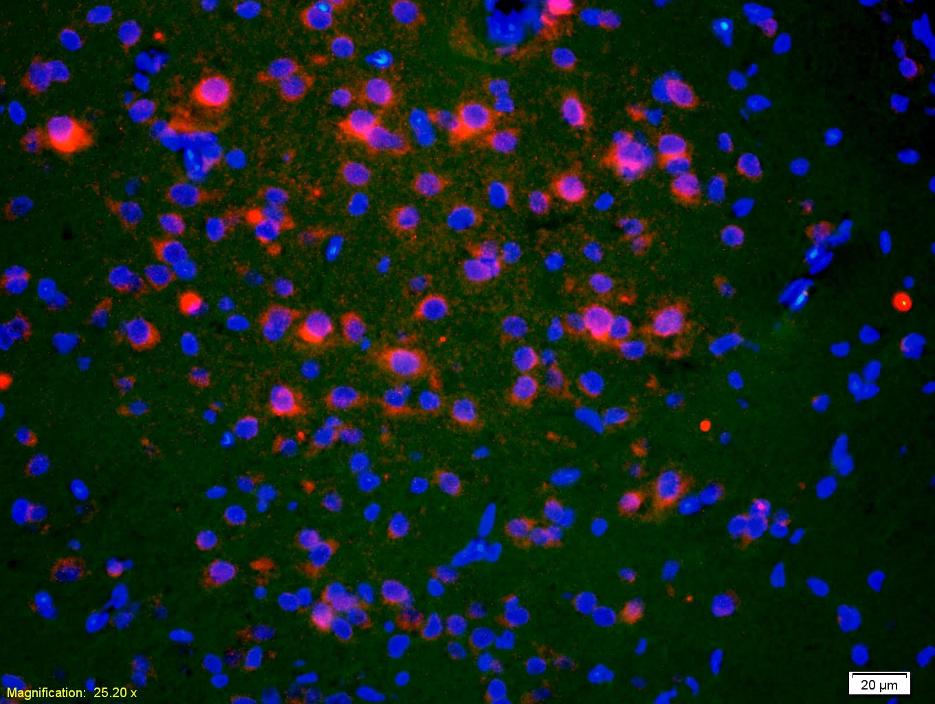 Anti-ACTH (1-39) Polyclonal Antibody