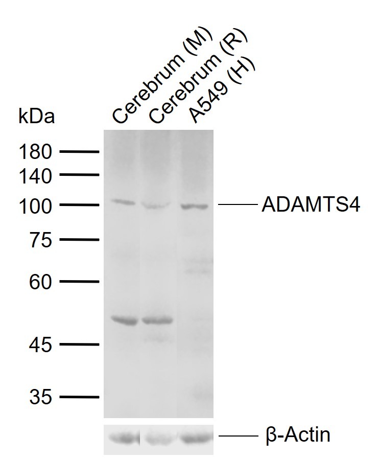 Anti-ADAMTS4 Polyclonal Antibody
