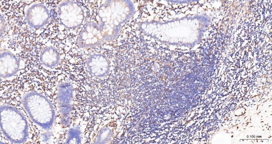 Anti-ADAM17 Polyclonal Antibody