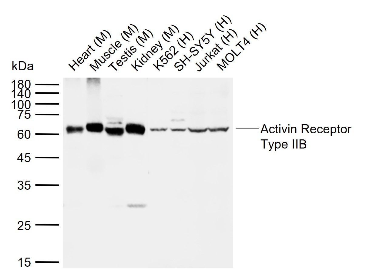 Anti-ACVR2B Polyclonal Antibody