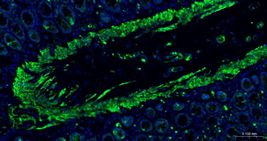 Anti-ACTA2 Antibody (1T673)