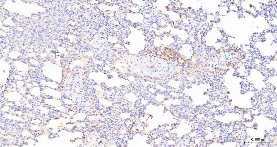 Anti-ADAM17 Polyclonal Antibody