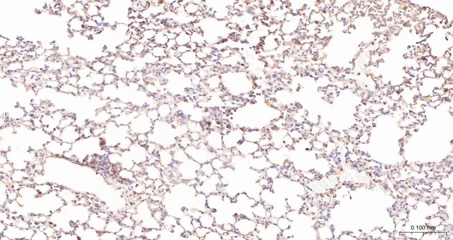 Anti-ADAM17 Polyclonal Antibody