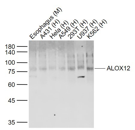 Anti-ALOX12 Polyclonal Antibody