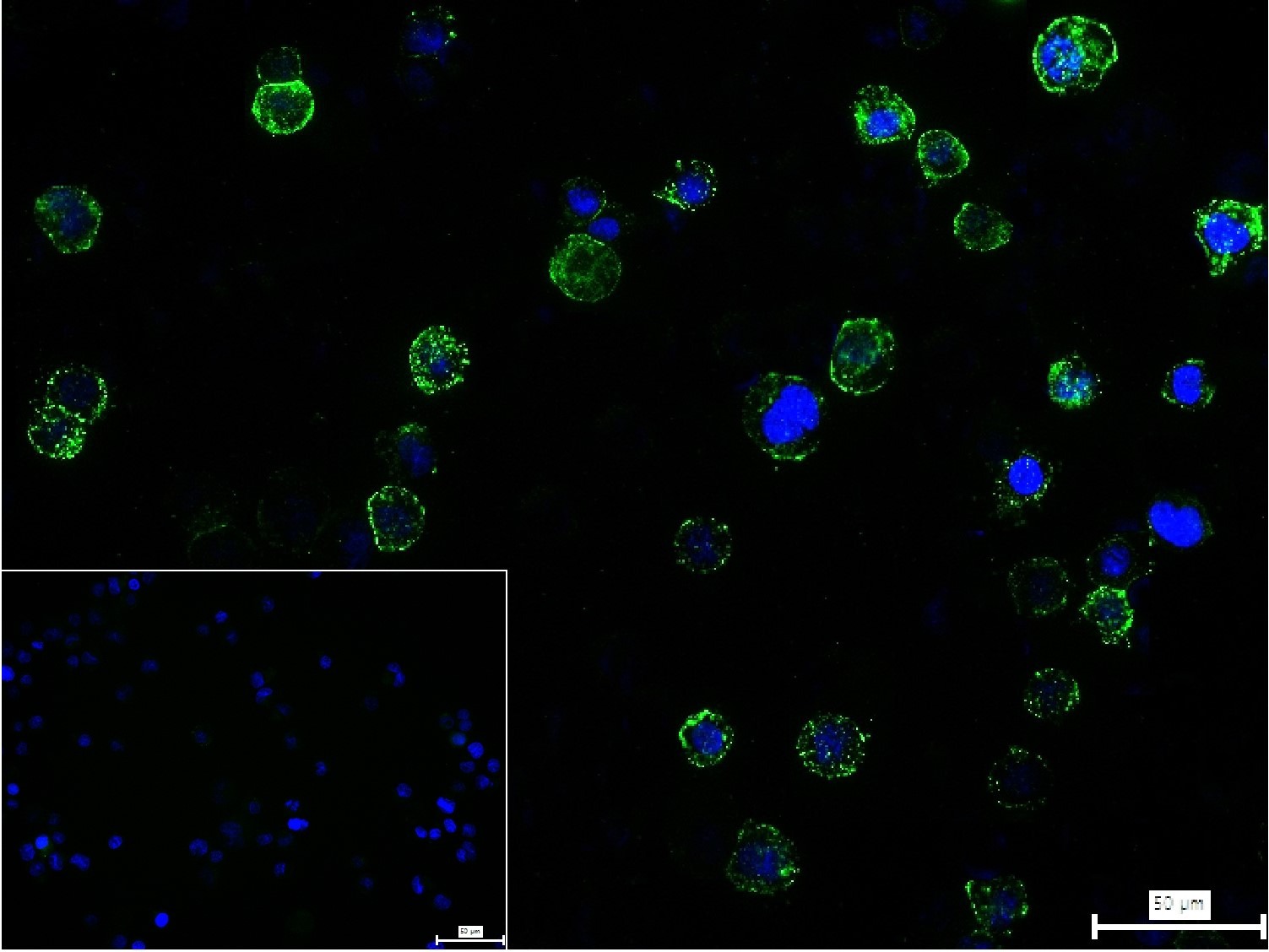 Anti-ADAM17 Polyclonal Antibody