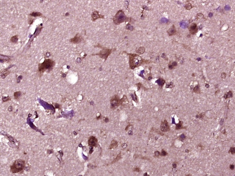 Anti-ABCA1 Polyclonal Antibody