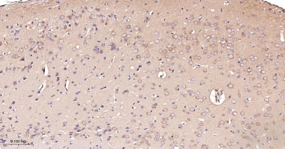Anti-ACSL4 Antibody (6H118)