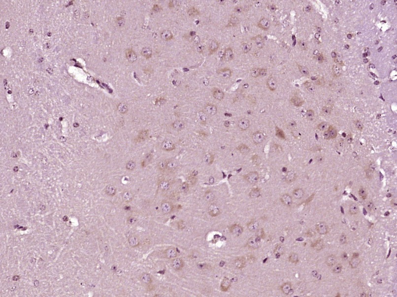 Anti-ABCG1 Polyclonal Antibody