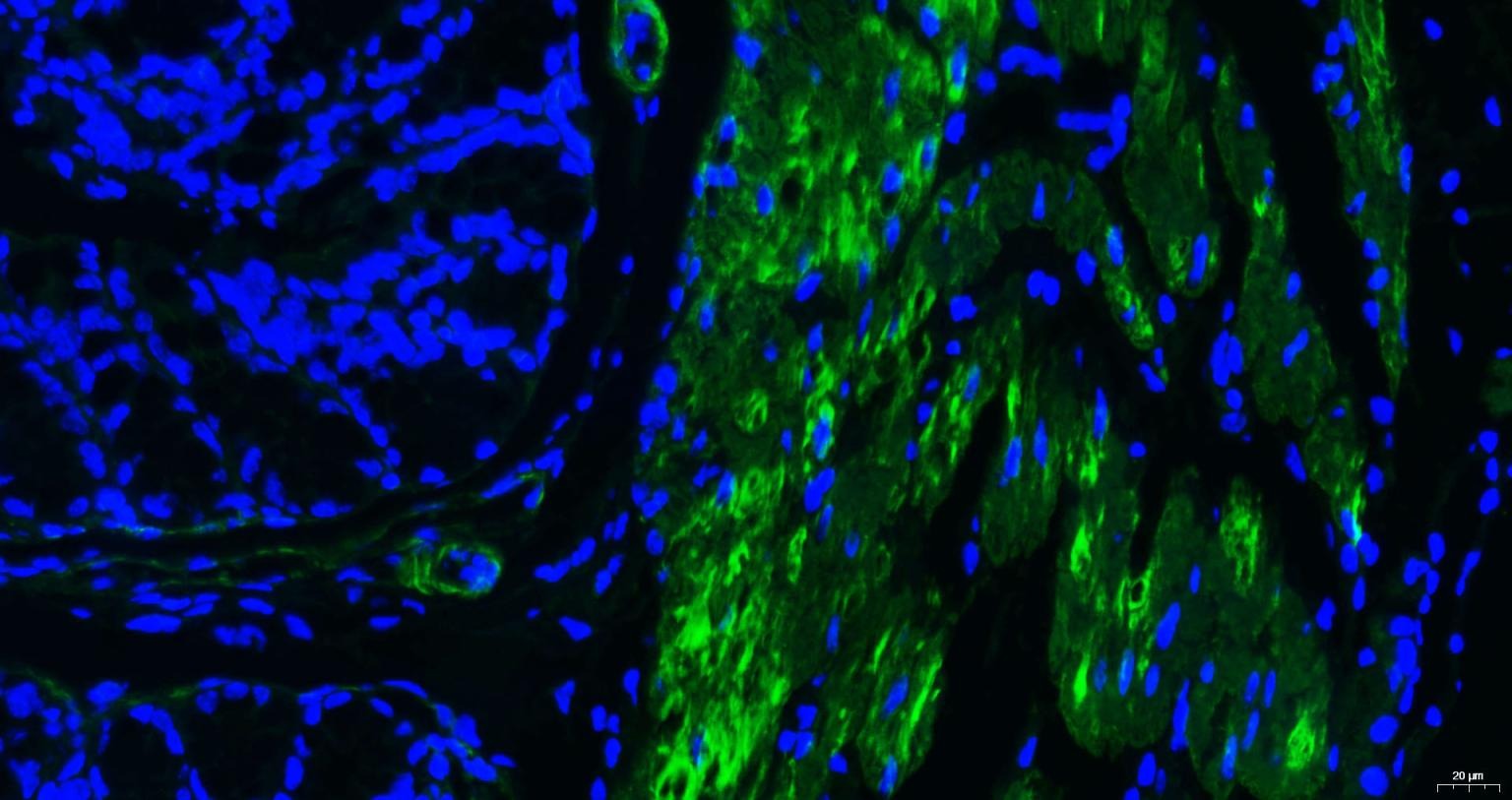 Anti-ACTA2 Antibody (6K554)