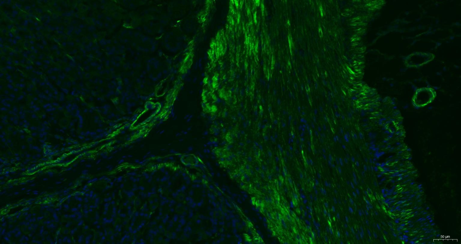 Anti-ACTA2 Antibody (7C949)