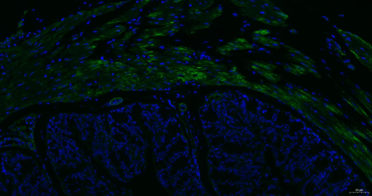 Anti-ACTA2 Antibody (7C949)