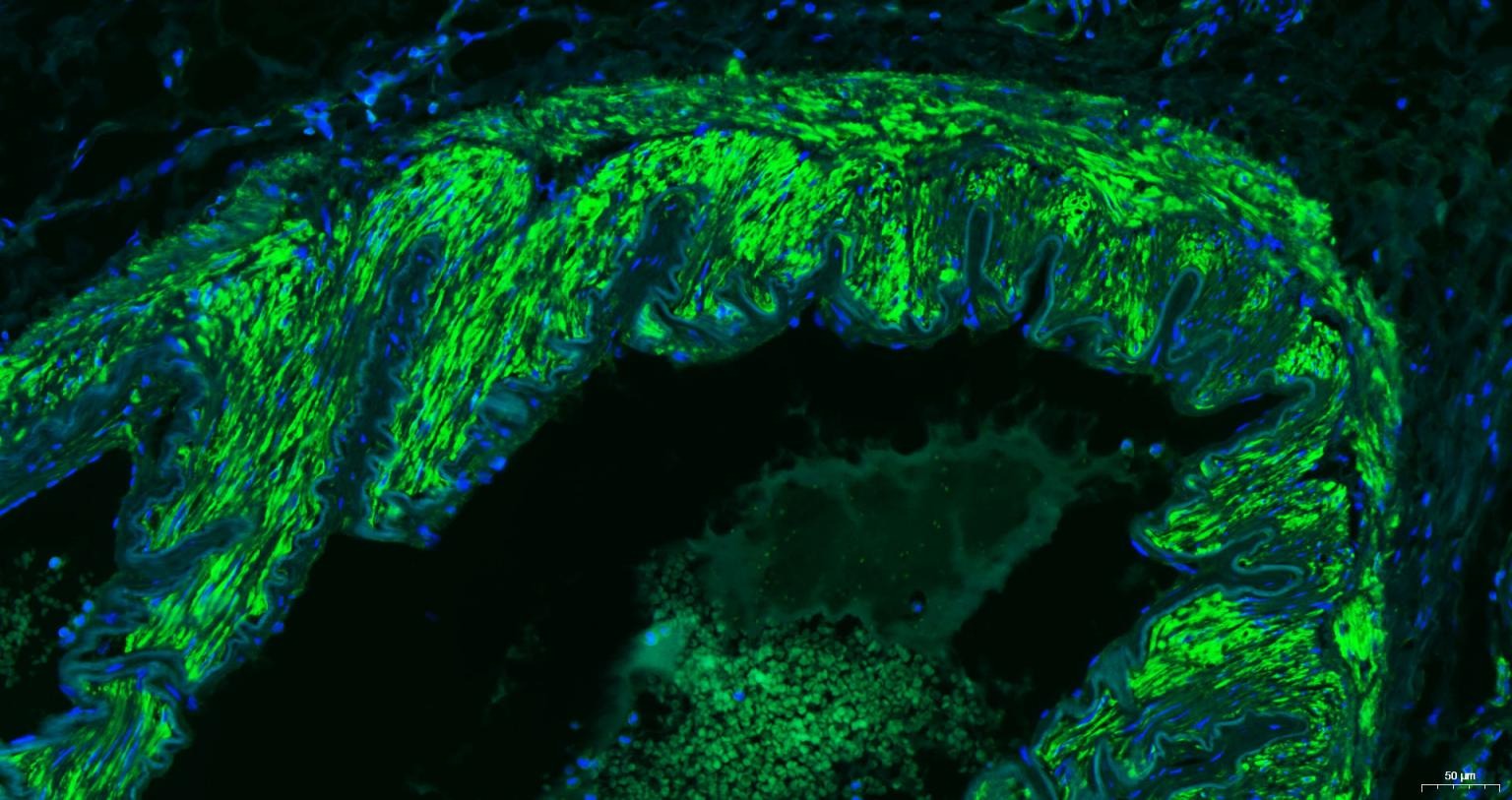 Anti-ACTA2 Antibody (6K554)
