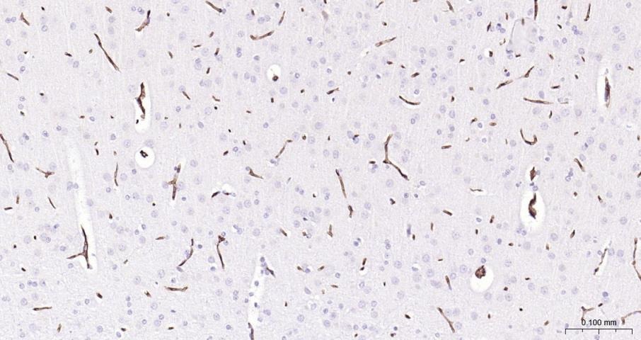 Anti-ABCB1 Polyclonal Antibody
