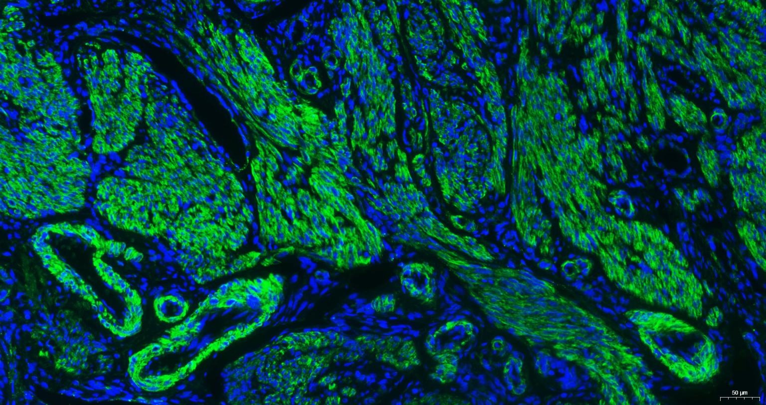 Anti-ACTA2 Antibody (6K554)