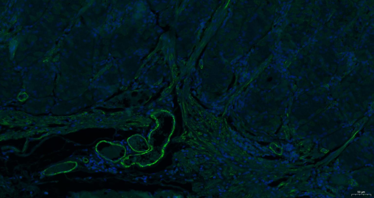 Anti-ACTA2 Antibody (7C949)