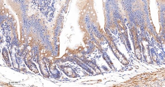 Anti-ACSL4 Antibody (6H118)