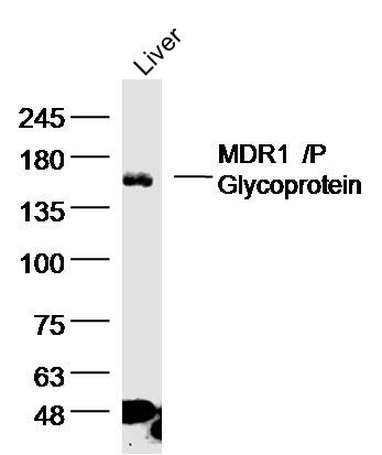 Anti-ABCB1 Polyclonal Antibody 2