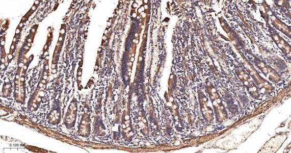 Anti-ACSL4 Antibody (6H118)