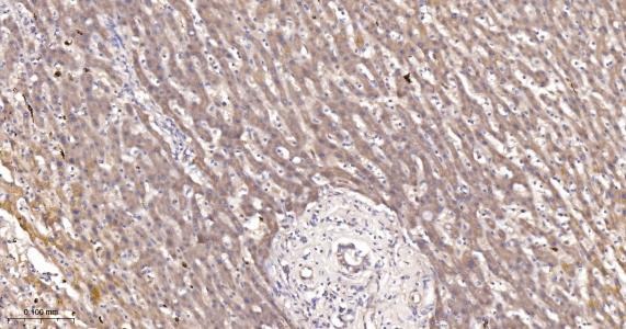 Anti-ACSL4 Antibody (6H118)