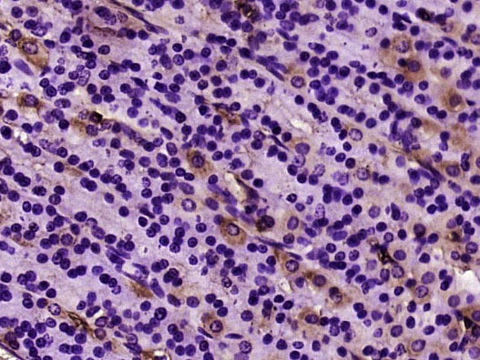 Anti-ACTA2 Antibody (7C949)