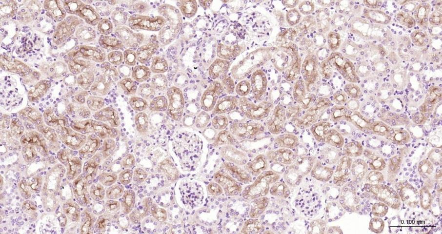 Anti-ABCB1 Polyclonal Antibody