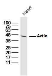 Anti-ACTA1 Polyclonal Antibody