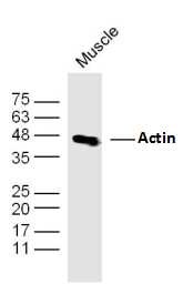 Anti-ACTA1 Polyclonal Antibody