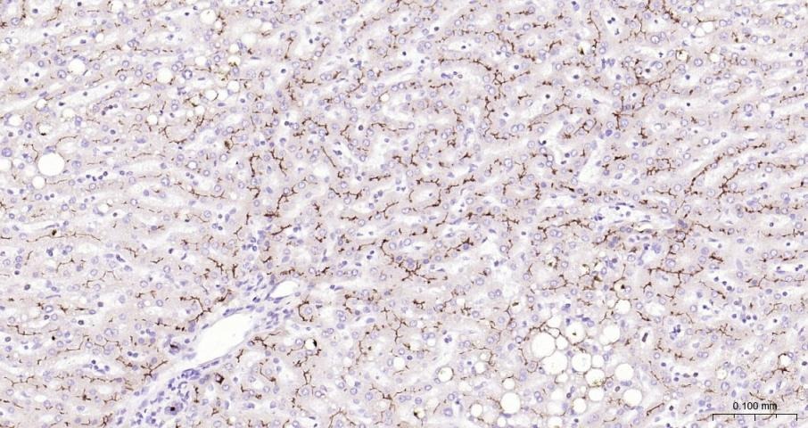 Anti-ABCB1 Polyclonal Antibody