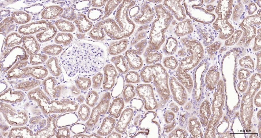 Anti-ABCB1 Polyclonal Antibody