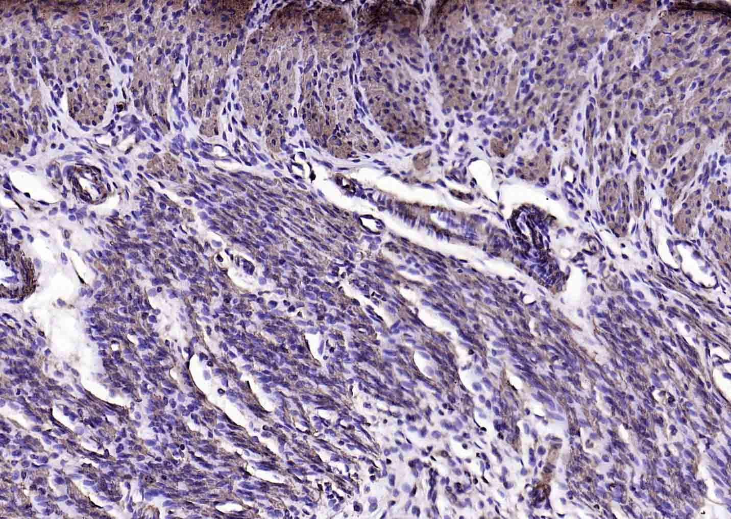 Anti-ACTA2 Antibody (7C949)