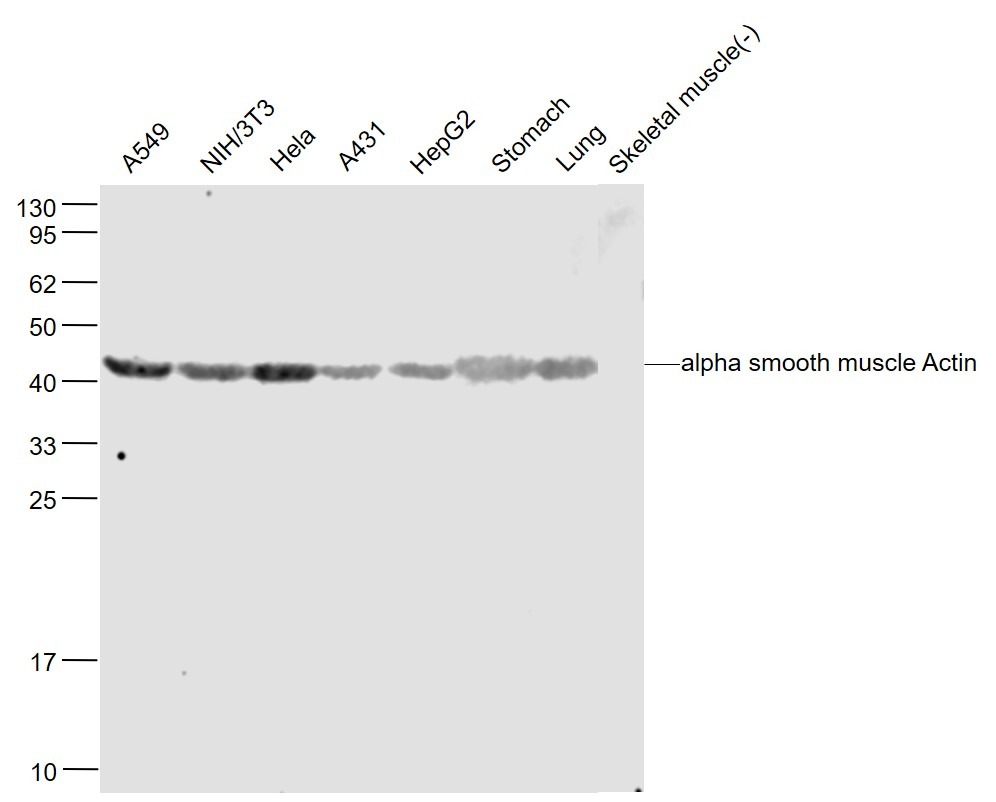 Anti-ACTA2 Polyclonal Antibody