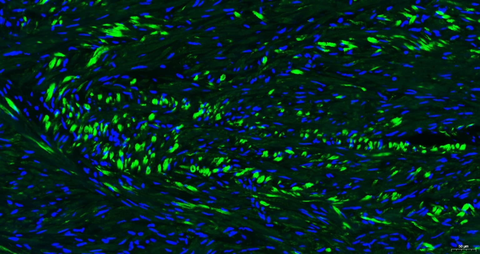 Anti-ACTA2 Antibody (6K554)