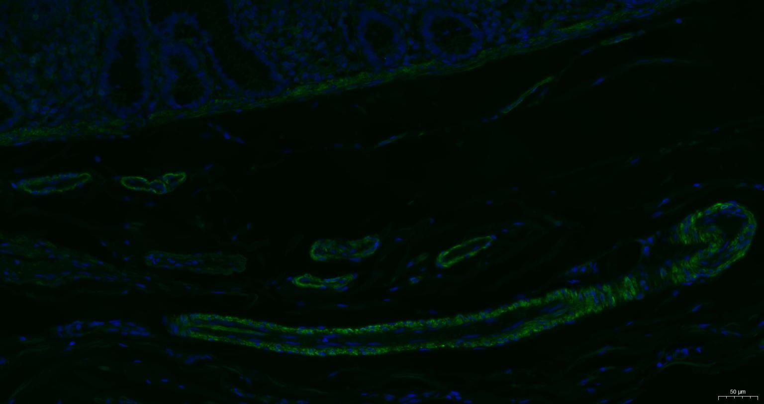 Anti-ACTA2 Antibody (7C949)