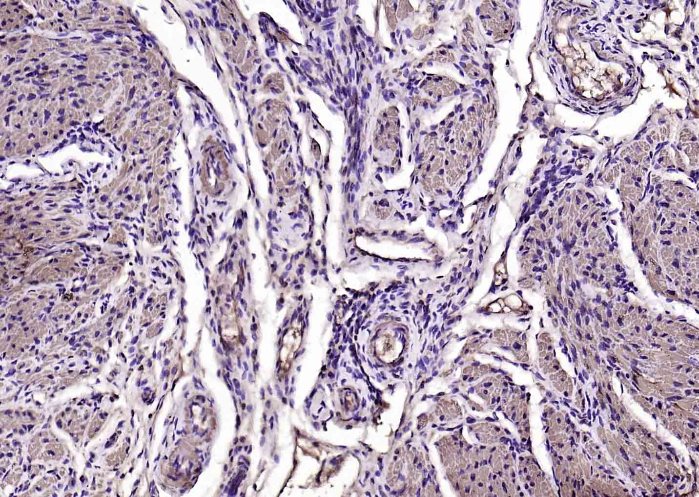 Anti-ACTA2 Antibody (6K554)