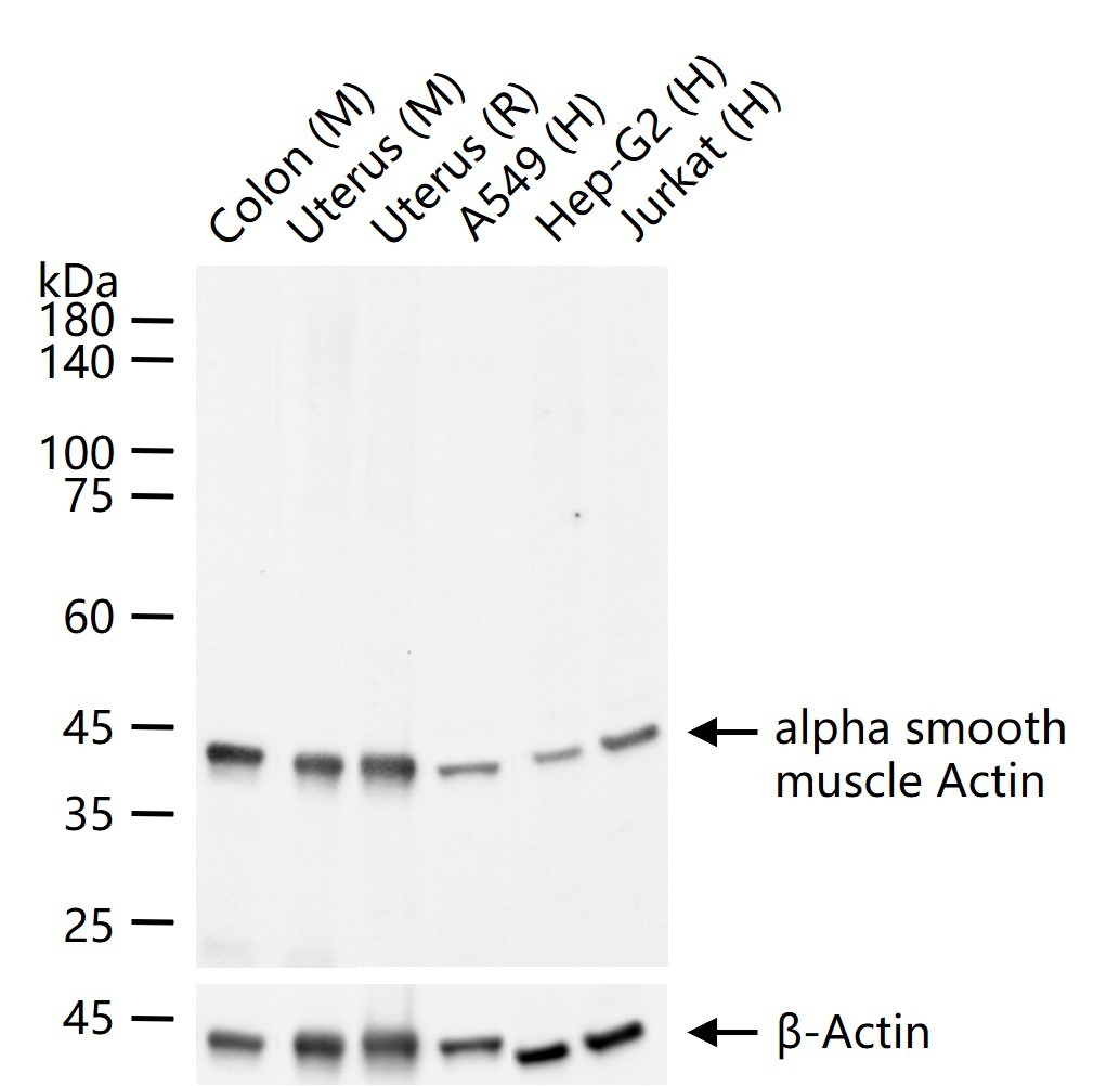 Anti-ACTA2 Antibody (7C949)