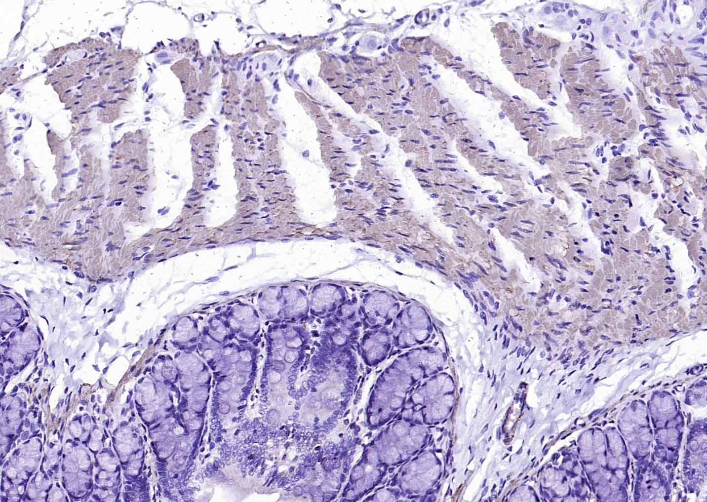 Anti-ACTA2 Antibody (7C949)