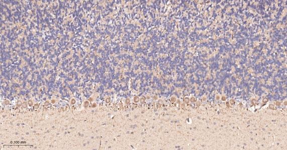 Anti-ACSL4 Antibody (6H118)