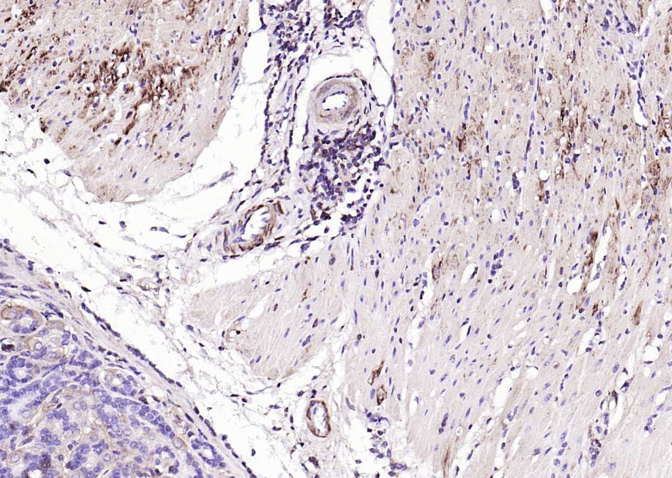 Anti-ACTA2 Polyclonal Antibody