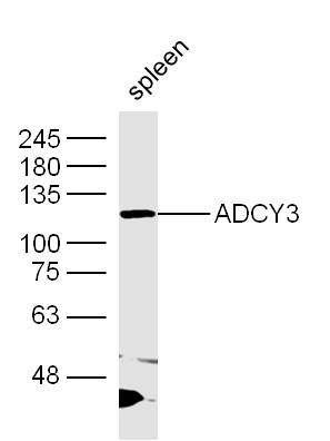 Anti-ADCY3 Polyclonal Antibody