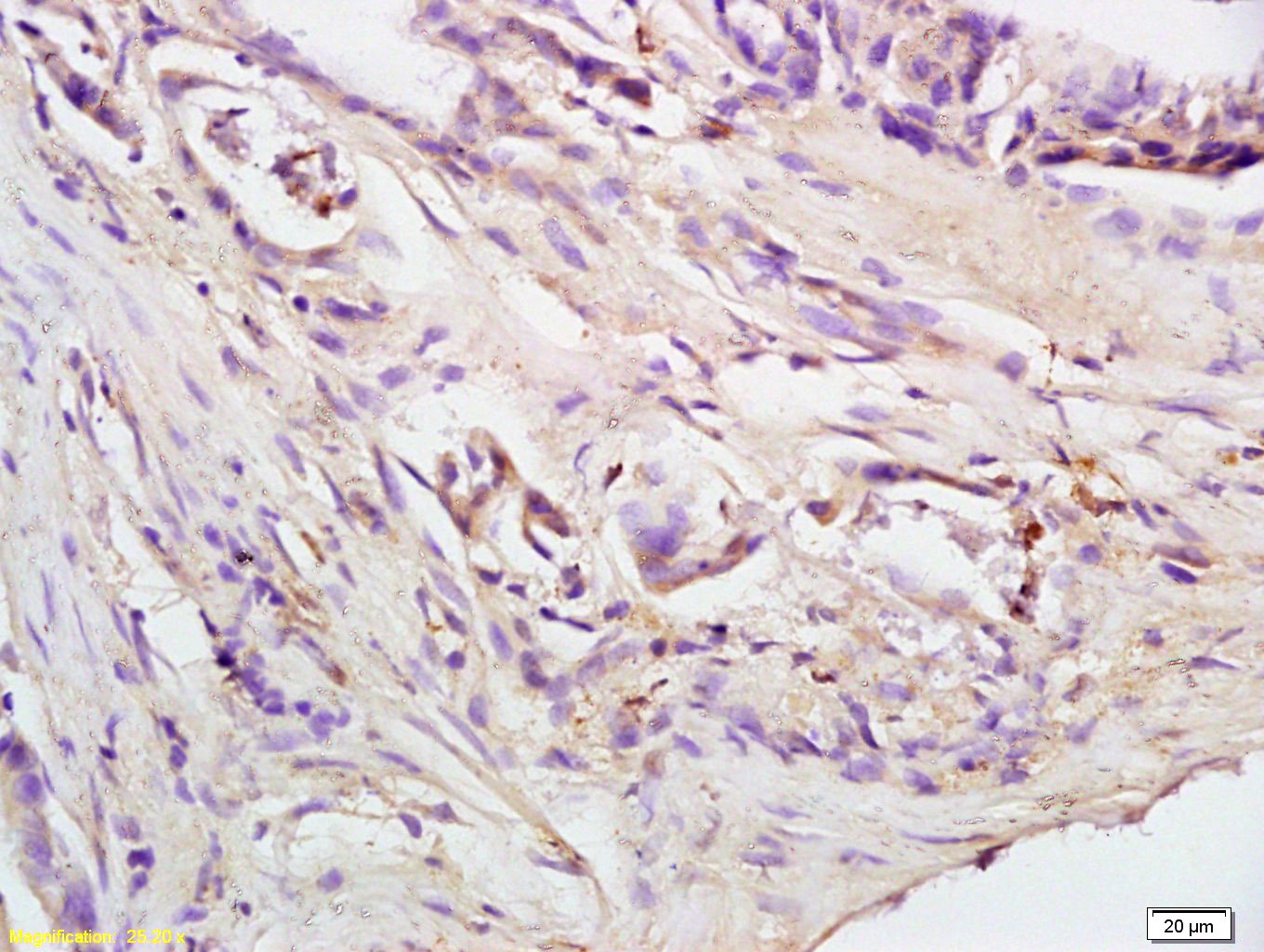 Anti-BAK1 Polyclonal Antibody