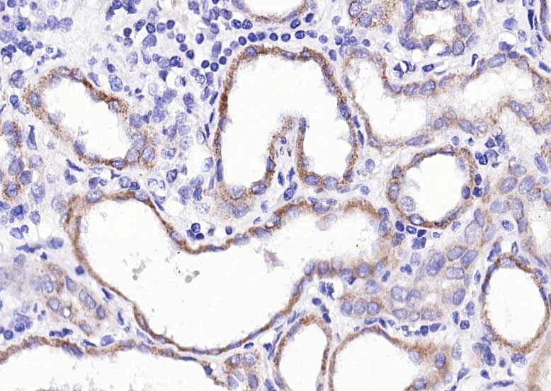 Anti-Aquaporin-4/AQP4 Polyclonal Antibody