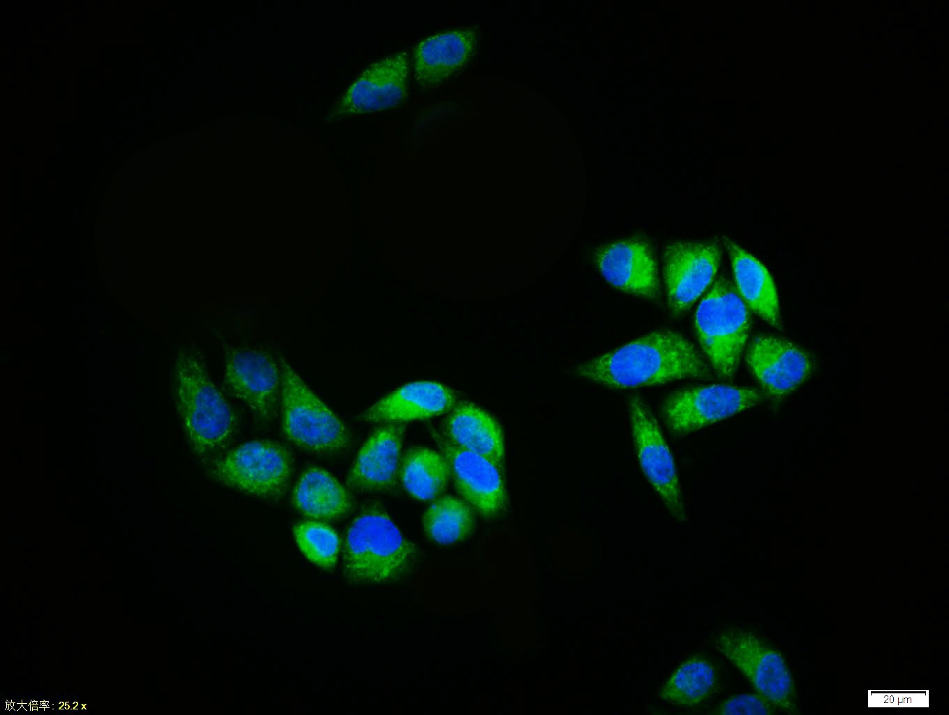 Anti-BACE1 Polyclonal Antibody