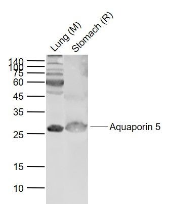 Anti-Aquaporin-5/AQP5 Polyclonal Antibody 2