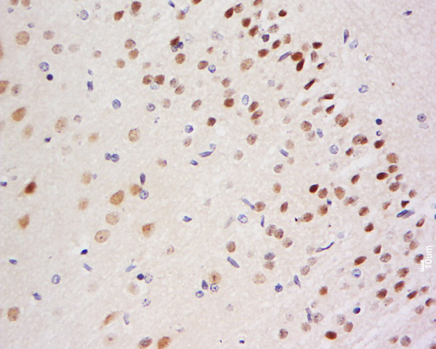 Anti-BACH1 Polyclonal Antibody