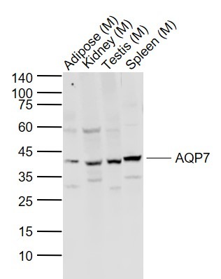 Anti-Aquaporin-7/AQP7 Polyclonal Antibody
