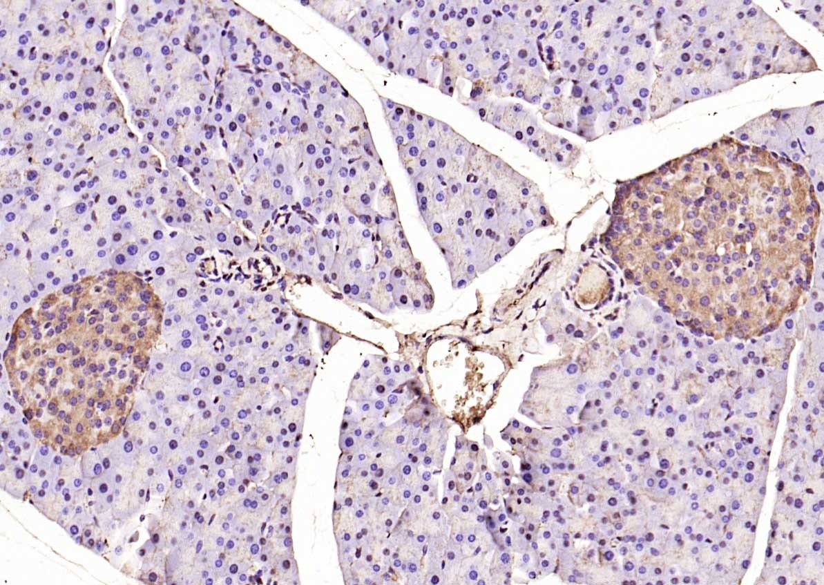 Anti-BACE1 Polyclonal Antibody