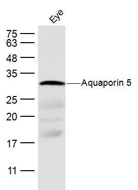 Anti-Aquaporin-5/AQP5 Polyclonal Antibody