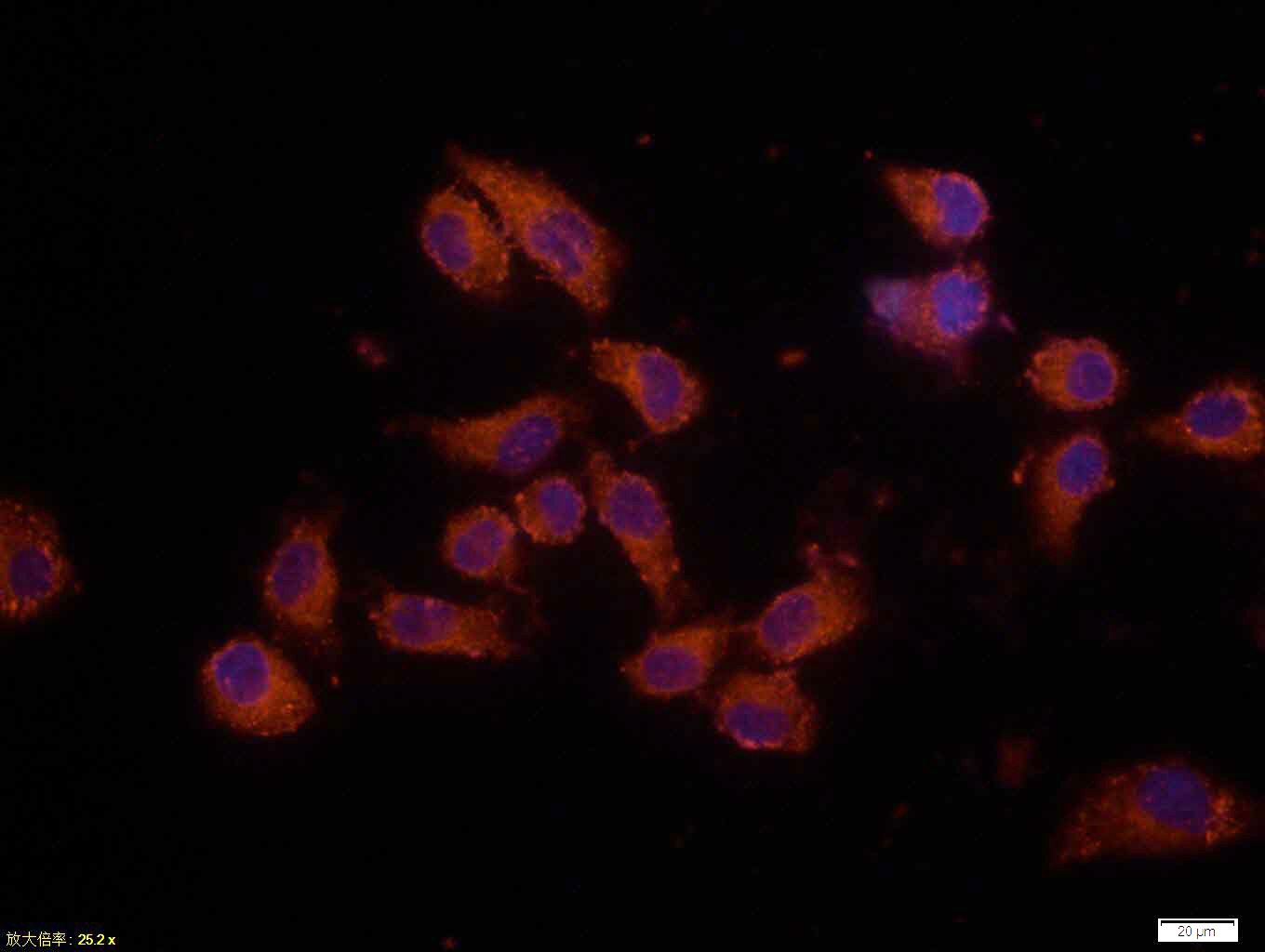 Anti-BAX Antibody (3I323)