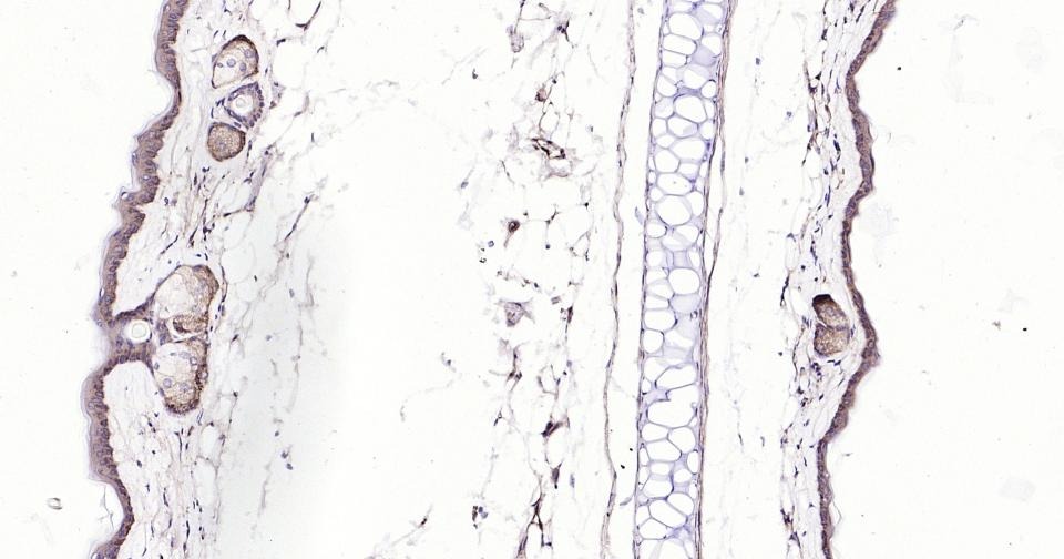 Anti-BAX Antibody (5X827)