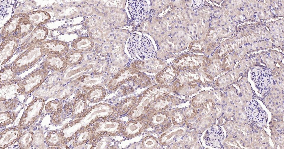 Anti-BAX Antibody (5X827)